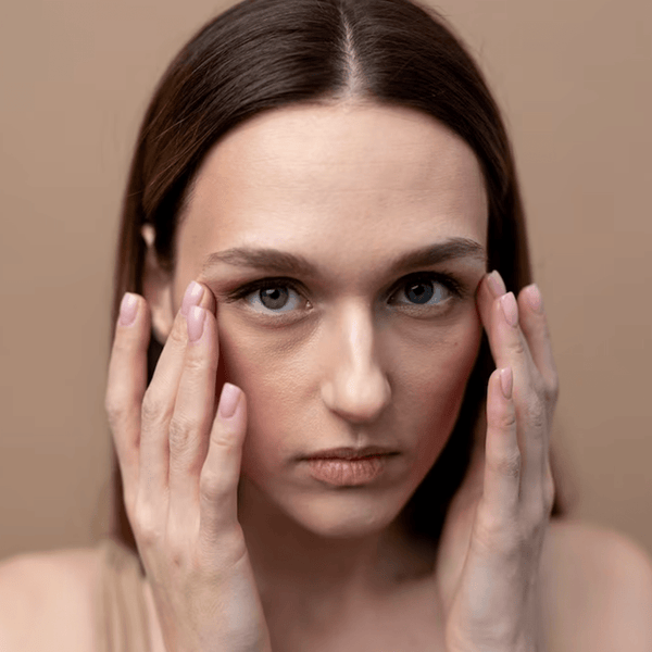 Dark Circles & Puffiness