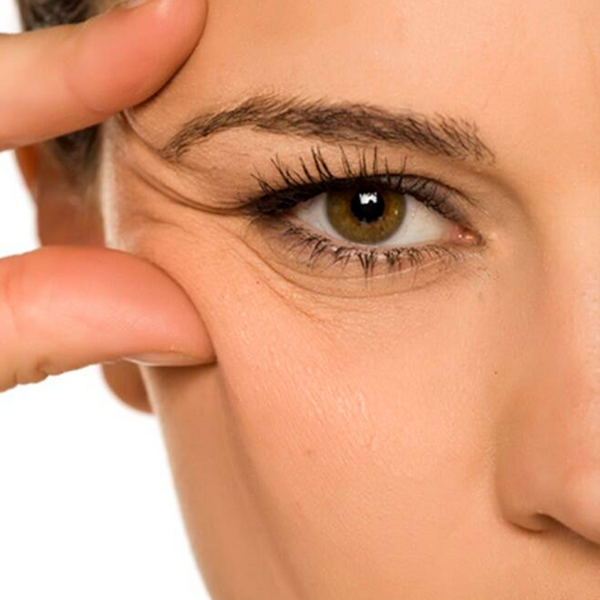 Wrinkles & Fine Lines